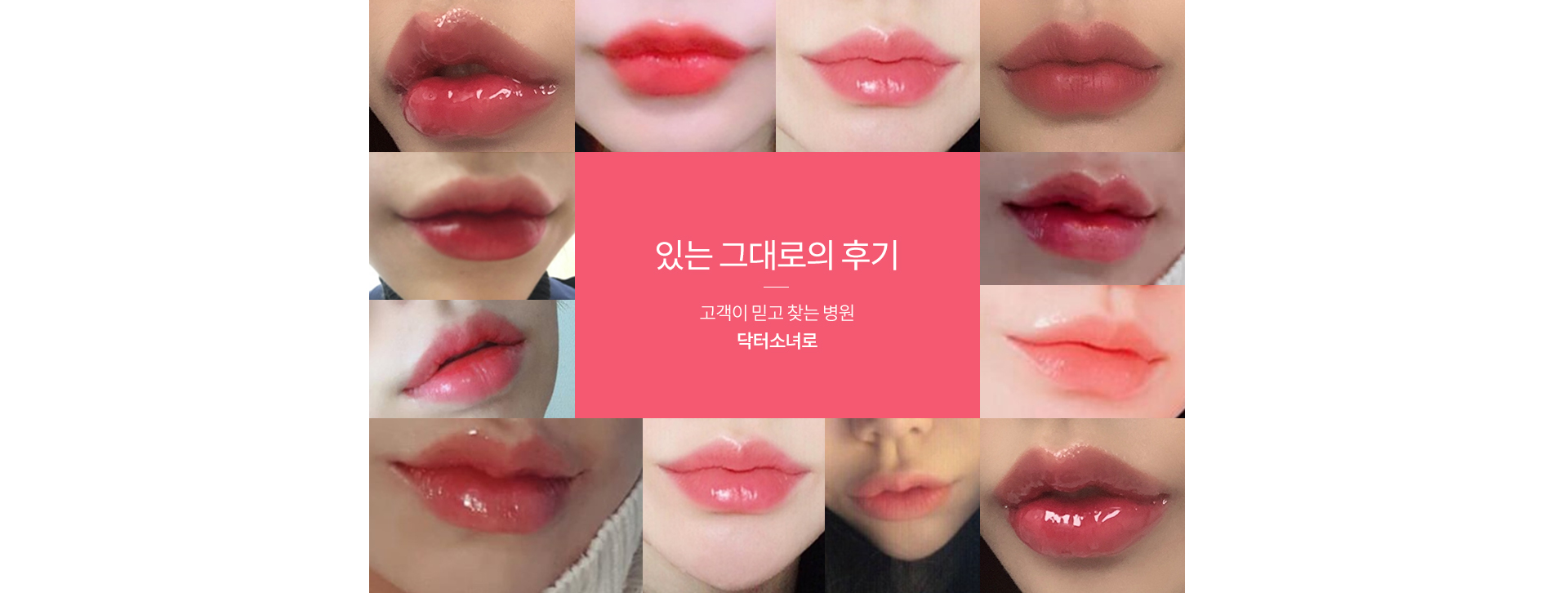 pc입술필러후기